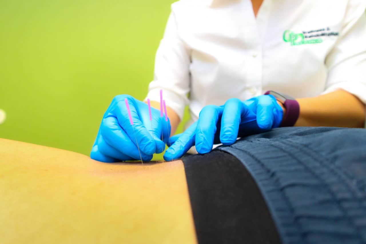 Functional Dry Needling Paloma Wellness and Rehab